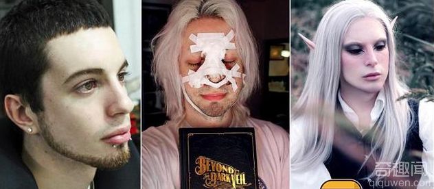 男子整容成精灵红眼尖耳 人不人鬼不鬼