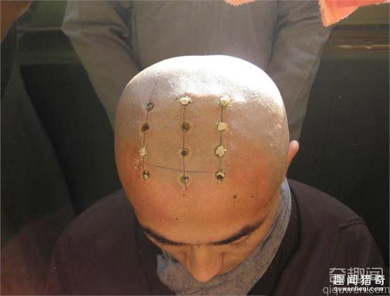 和尚头上为什么有点？和尚有点原来是这个原因