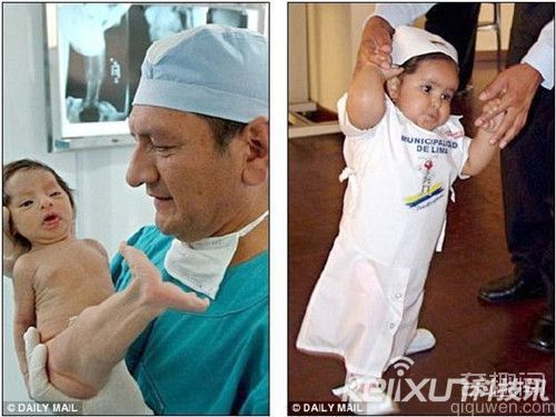 美人鱼传闻太美好  现实系致命性疾病